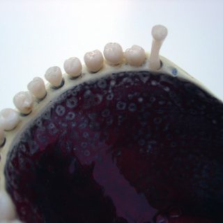 Teeth Dreams (dish, detail), 2005